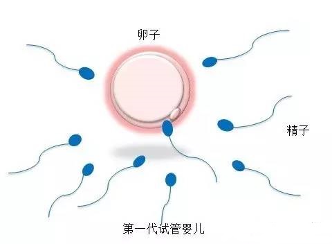三代试管生儿子